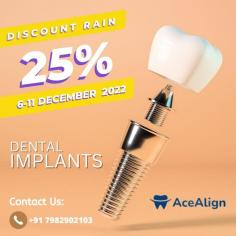 Ace align is your one stop solution for all your dental needs. There has been a dynamic change in the field of dentistry that has changed not only patients' perceptions but also traditional dental techniques to modern dentistry. Consult with our expert dental specialists for your tooth & gum problems. We are experts in performing dentistry in a painless & affordable way. All treatments like root canal treatments, dental fillings, tooth extraction, smile designing, etc are performed.