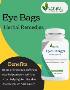 Are you looking for Home Remedies for eye bags? If yes, then you should definitely try out the range of herbal supplements from Natural Herbs Clinic.
