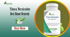 "Natural Remedies for Tinea Versicolor
Here you can find various types of natural remedies for tinea versicolor that can treat it very well.
https://natural-herbs-clinic1.my-free.website/blog/post/2198283/natural-remedies-for-tinea-versicolor"
