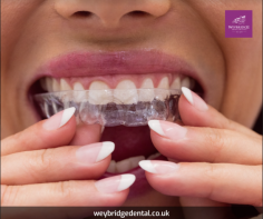 Invisible braces, also known as clear aligners, offer several benefits over traditional metal braces. Here are some of the main benefits of invisible braces in surrey,

Discreet Appearance: Invisible braces are made from clear plastic and are virtually invisible, making them a popular choice for adults and teens who may be self-conscious about wearing traditional braces.
	
Comfort: Invisible braces are made from smooth, comfortable plastic that is less likely to cause irritation to the cheeks and gums compared to traditional braces.
	
Removable: Invisible braces can be easily removed for eating, drinking, and brushing and flossing, which can make them more convenient to use and allow for better oral hygiene during treatment.
	
Customized Treatment: Invisible braces are custom-made for each patient and are designed to gradually move teeth into the desired position over time.
	
Faster Results: In some cases, treatment with invisible braces can take less time than traditional braces, depending on the severity of the dental problem being addressed.
	
Reduced Dental Visits: Patients using invisible braces typically require fewer office visits with their dentist or orthodontist compared to traditional braces, which can be more convenient for patients with busy schedules.
	
Predictable Results: Invisible braces use advanced computer technology to plan and map out the entire course of treatment, allowing patients to see the final results before treatment even begins.
	
Overall, invisible braces can offer a more convenient, comfortable, and discreet way to straighten teeth compared to traditional metal braces. However, it's important to speak with a dental professional to determine if invisible braces are the right option for your specific dental needs.