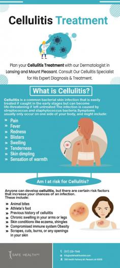 At Safe Health PC in Lansing MI, we offer expert cellulitis treatment to help you get relief from this painful and potentially serious condition. Our experienced medical professionals will work with you to diagnose the cause of your cellulitis and develop a personalized treatment plan that addresses your symptoms and underlying condition.