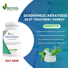 Are you looking for Home Treatment for Seborrheic Keratosis? Look no further than Natural Herbs Clinic! Seborrheic keratosis is a common skin condition characterized by wart-like lesions on the face, chest, back, and scalp. Although harmless, these lesions can become itchy and uncomfortable.
