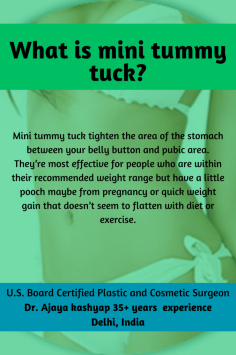 Mini tummy tuck tighten the area of the stomach between your belly button and pubic area.
They’re most effective for people who are within their recommended weight range but have a little pooch maybe from pregnancy or quick weight gain that doesn’t seem to flatten with diet or exercise.