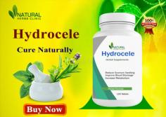 The Natural Remedies for Hydrocele can improve your overall health and well-being while also assisting you in managing the illness.