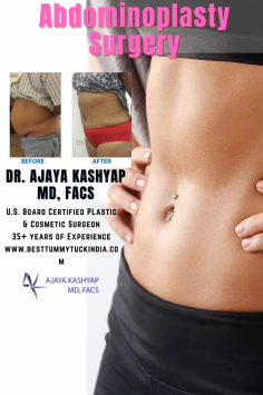 Get the most advanced surgical treatment for Tummy Tuck  by Medspa - Cosmetic & Plastic Surgery Clinic
Now discover you after looks for your Abdominoplasty Procedure with #crisalix as we can now guide you towards your post surgical experience before your surgery.
Book a consultation with Dr. Ajaya Kashyap today and get started with all the information regarding your cosmetics surgery.
Book your consultation: +91-9958221983/82/81 