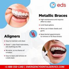 Make an educated choice for the orthodontic procedure by learning the benefits and drawbacks of metal braces and aligners. To know more about Metal Braces and Aligners, contact Emergency Dental Service at +1-888-350-1340. We also provide dentists for emergency dental care in case of any dental emergency