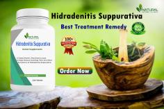 In this article, we will explore the top Herbal Remedies for Natural Relief for Hidradenitis Suppurativa and their potential benefits.
