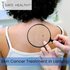 Skin Cancer Specialists Lansing: Providing expert diagnosis, treatment, and compassionate care for all types of skin cancer. Trust our experienced dermatologists to safeguard your skin health and guide you towards a brighter, cancer-free future. For more information visit our website. 

