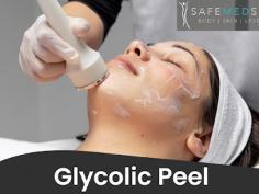 Experience the rejuvenating power of a Glycolic Peel Facial treatment at Safe Med Spa. Our skilled professionals utilize a gentle yet effective formula to exfoliate the skin, revealing a fresh and radiant complexion. Contact us today to Book your appointment and experience the glycolic peel facial treatment.
