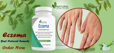 Discover Natural Treatments for Eczema to help relieve the pain and discomfort of eczema on hands and fingers. Learn about home remedies.
