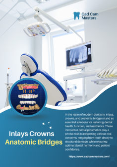 In the realm of modern dentistry, inlays, crowns, and anatomic bridges stand as essential solutions for restoring dental health, function, and aesthetics. These innovative dental prosthetics play a pivotal role in addressing various oral concerns, ranging from tooth decay to structural damage, while ensuring optimal dental harmony and patient confidence.