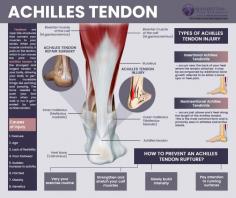 What Is Achilles Tendon?
The Achilles Tendon is the longest and most powerful tendon in the body but can become inflamed and painful, resulting in Achilles Tendinitis. Prolonged Achilles tendinitis without treatment and diagnosis by podiatrists can result in tearing and weakening of the tendon. Typically, Our podiatrists treat Achilles tendinitis through conservative measures such as stretching, custom orthotics, physical therapy, and X-rays which can be implemented during an office visit.

In some instances, further imaging such as an MRI may be necessary to rule out tearing or fibrosis of the Achilles Tendon. If torn, the Achilles tendon may require surgical repair to ensure the best quality of life for the patient. An evaluation by a doctor is always necessary for an accurate diagnosis and treatment.

Achilles Tendon Pain
The Achilles tendon is not only the largest in our body. It is also the strongest, having the ability to withstand up to 1,000 lbs of force! With every step, the Achilles acts to propel our body forward over our feet. Life in an active city such as New York inevitably results in an incredible amount of stress to this tendon, even on a typical day. Achilles tendon pain, tendinitis, tears, or other injuries can significantly affect the quality of life, ability to achieve health and fitness goals, and ability to work.

Despite its power, the Achilles tendon is also prone to injury. Areas of this important Achilles tendon lack a direct blood supply causing weakness and delayed healing in those regions. Achilles tendon injuries are widespread in tennis, basketball, and soccer and should be seen by a foot and ankle specialist immediately. Podiatrist, Our Podiatrists are specialists in Achilles injuries and offers conservative and surgical treatments.

Read more: https://www.footdoctorpodiatristnyc.com/treatment/achilles-tendon/

Manhattan Foot Specialists
Union Square
55 W 17th St STE 106,
New York, NY 10011
(212) 378-9991

Upper East Side
983 Park Avenue, Ste 1D14,
New York, NY 10028
(212) 389-1886
Web Address https://www.footdoctorpodiatristnyc.com
https://footdoctorpodiatristnyc.business.site/
E-mail info@footdoctorpodiatristnyc.com 

Our locations on the map:
Union Square https://goo.gl/maps/kea5dAUJenh1m85y5
Upper East Side https://goo.gl/maps/WjiEhPH6ydZxPGHfA

Nearby Locations:
Union Square
Gramercy Park | Rose Hill | Kips Bay | Nomad | Murray Hill | Koreatown
10010 | 10016 | 10453 | 10017

Nearby Locations:
Upper East Side
Yorkville | Manhattan Valley | Lenox Hill | Sutton Place | Carnegie Hill | East Harlem
10028 | 10025 | 10021| 10022 | 10029

Working Hours Union Square & Upper East Side:
Monday: 8AM - 7PM
Tuesday: 8AM - 7PM
Wednesday: 8AM - 7PM
Thursday: 8AM - 7PM
Friday: 8AM - 5PM
Saturday: Closed
Sunday: Closed

Payment: cash, check, credit cards.