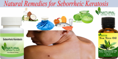 You can use fish oil as your Natural Remedies for Seborrheic Keratosis. Also, you can use a krill oil supplement. Both home remedies can help you to rid of the toxic rancid fat as well as from preventing it to accumulate in the body.
