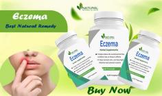 Eczema Home Treatments: Herbal Remedies to Soothe Your Skin
Explore the world of Eczema Home Treatments with these natural wonders. Learn about herbal supplements for eczema and effective home remedies to soothe your skin.
https://www.naturalherbsclinic.com/blog/eczema-home-treatments-herbal-remedies-to-soothe-your-skin/
