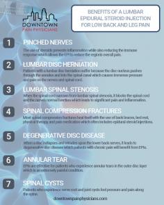 Epidural Steroid Injections in Downtown Brooklyn & Lower Manhattan
Back and nerve pain is difficult to deal with. It causes a lack of concentration, makes it difficult to sleep, and generally takes up space in your mind and consumes your thoughts. An epidural steroid injection is a solution for pain relief from your pain. At Downtown Pain Physicians, our goal is to provide you with relief from the pain you have in a safe and professional manner.

Epidural steroid injections are one of the most common procedures that we perform in our office. As pain relief specialists, we understand what conditions respond best to this treatment and who would benefit from it the most. Because of our extensive experience with this treatment, we can answer your answer any questions and concerns that you have. Our goal is to make sure that you feel safe and confident during your epidural steroid injection procedure, and ultimately, that it gives you the pain relief that you need.

Read more: https://www.downtownpainphysicians.com/epidural-steroid-injections/

Downtown Pain Physicians Of Brooklyn
145 Henry Street, # 1G,
Brooklyn, NY 11201
(718) 521-2424
Web Address https://www.downtownpainphysicians.com/
https://downtownpainphysicians.business.site/

Our location on the map: https://g.page/paindrbrooklyn

Nearby Locations:
Dumbo | Vinegar Hill | Bridge Plaza | Brooklyn Heights | Cobble Hill | Boerum Hill
11201 | 11251 | 11231 | 11217

Working Hours:
Monday: 08.00AM - 07.00PM
Tuesday: 08.00AM - 07.00PM
Wednesday: 08.00AM - 07.00PM
Thursday: 08.00AM - 07.00PM
Friday: 08.00AM - 07.00PM
Saturday: Closed
Sunday: 08.00AM - 07.00PM

Payment: cash, check, credit cards.