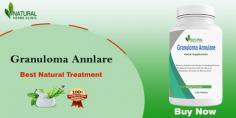 Herbal Treatment for Granuloma Annulare: A Natural Approach to Healing
In this article, we will explore what Granuloma Annulare Home Remedies are, and their causes, and delve into a variety of herbal treatments and home remedies that can provide relief.
https://medium.com/@walamdavid456/herbal-treatment-for-granuloma-annulare-a-natural-approach-to-healing-5f97cddc06c7
