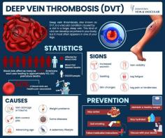 Deep vein thrombosis or DVT is a potentially dangerous condition that needs medical attention. A blood clot in the leg can break loose and travel up to your lungs, causing a life-threatening pulmonary embolism. In addition, left untreated, this condition causes deterioration of the venous valves, leading to severe venous insufficiency, leg swelling, hyperpigmentation and ulcers. To avoid the danger, seek deep vein thrombosis treatment from a DVT doctor like Dr. Sergei Sobolevsky at the Downtown Vein & Vascular Center in Brooklyn. An expert in diagnostic radiology, he finds the blood clot and then removes the threat. Call today for decisive diagnosis and fast treatment.

What Is Deep Vein Thrombosis?
Deep vein thrombosis, also known as DVT, is a vascular condition caused by a clot in a large, deep vein. This kind of clot can develop anywhere in your body, but it most often appears in one of your legs. The vein condition presents severe symptoms, including pain and swelling that can become chronic and affect your daily life.

If left untreated, the deep vein blood clot can break loose and travel through the vein to your lungs, where it can cause a life-threatening pulmonary embolism (PE), which requires immediate medical treatment. An early diagnosis for a blood clot in a deep vein can save your life. At the Downtown Vein & Vascular Center in Brooklyn, Dr. Sergei Sobolevsky, a leading endovascular specialist, leads an expert team to offer effective, life-saving treatment.

Read more: https://www.downtownveinvascular.com/deep-vein-thrombosis-dvt-blood-clot-in-the-leg/

Downtown Vein Treatment Center
480 Court Street, Ste 101
Brooklyn, NY 11231
(718) 787-5559

Web Address: https://www.downtownveinvascular.com/

Our location on the map: https://goo.gl/maps/4NjFCLeFDSpawN3v5

Nearby Locations:
Carroll Gardens, Red Hook, Columbia Street Waterfront District, Cobble Hill, Boerum Hill, Park Slope
11231, 11201, 11215, 11217

Working Hours:
Monday-Friday: 9am - 5pm

Payment: cash, check, credit cards.