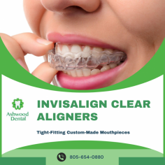 Invisible Aligners For Your Teeth

Our specialized team of experts will create a customized invisible aligner plan designed just for your smile. We provide orthodontic treatment to straighten your teeth and help you achieve your dream. For more information, mail us at emily.ashwooddental@gmail.com.