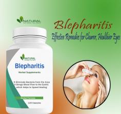 Blepharitis Natural Remedies: A Holistic Approach to Eye Health
In a world dominated by screens and digital devices, eye health has become a concern for many. One common eye condition that plagues individuals is blepharitis. This article explores Blepharitis Natural Remedies and herbal treatments.
https://www.naturalherbsclinic.com/blog/blepharitis-natural-remedies-a-holistic-approach-to-eye-health/
