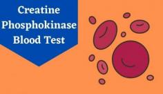 Check out this complete guide on the Creatine phosphokinase (CPK) test to measure this enzyme that plays a pivotal role in muscle function. Learn more about CPK blood test at Livlong.