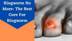 If you're looking for the best ringworm treatments, you've come to the right place. The IIFL blog is a great resource for all things related to skin care. Find unique tips about ringworm treatments that you can use today.