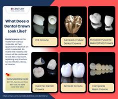 What is a Dental Crown?
A dental crown is a restoration that covers a natural tooth right down to the gum line. The crown is made to fit tightly over the tooth, sealing it completely around the margin, just below the gum line. Because the entire tooth is covered, it is protected from damage preventing infection and decay. A dental crown can be made from various materials depending on the location of the tooth, patient preferences, and budget.

When Do You Need a Dental Crown?
If you have a tooth that is uncomfortable or painful or is significantly decayed or damaged, you might need a crown to restore it. Typically, we will suggest a dental crown to restore a tooth that is infected and requires root canal therapy, or has suffered from decay or is damaged by trauma, such as a blow to the mouth or vehicle accident, resulting in a loss of much of its structure.

Crowns restore teeth that have lost too much of their original structure to be restored with a filling. If we were to try repairing the tooth with a filling, there would be a real risk that the tooth could crack or crumble away when you bite or chew or that it could become infected.

In cosmetic dentistry, we can use dental crowns to cover teeth that are worn, too small, or not an ideal shape but are not necessarily damaged or decayed. Dental crowns can also be used to restore dental implants.

What Does a Dental Crown Look Like?
Dental crowns can be made from various materials, so their appearance depends on which is selected. No matter the material, the crown will be contoured to look like a real tooth, replacing any structure lost to infection, decay, or trauma.

Read more: https://www.centurymedicaldental.com/dentistry/dental-crown/

Century Dentistry Center
827 11th Ave Ground Floor
New York, NY 10019
(212) 929-2202
Web Address https://www.centurymedicaldental.com/dentistry/

Our location on the map: https://maps.app.goo.gl/34T4HmeGp73S6pFQ8
https://plus.codes/87G8Q2C5+27 New York

Nearby Locations:
Hell's Kitchen | Upper West Side | Midtown West | Chelsea | Midtown East | Little Brazil
10036 | 10023, 10024, 10025, 10069 | 10019 | 10001, 10011 | 10022

Working Hours:
Monday- Friday: 9:00 am - 6:00 pm
Saturday: 9:00 am - 4:00 pm
Sunday: Closed

Payment: cash, check, credit cards.