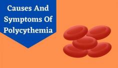 Primary polycythemia also known as polycythemia vera causes mainly due to abnormalities in red blood cells.