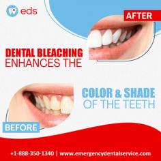 Dental Bleaching | Emergency Dental Service

Brighten your smile with Dental Bleaching! Say goodbye to stubborn stains and hello to a dazzling, confident grin.  Enhance the color and shade of your teeth with our professional dental bleaching. Schedule an appointment at 1-888-350-1340. 

