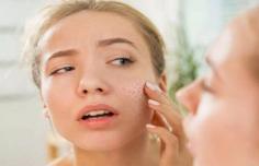 Looking for effective home remedies for dry skin? Here are 8 best home remedies to treat dry skin and face problems naturally including Honey, Avocado Oil, Rice Water, Aloe Vera, Papaya Toner, Milk, Apricot Kernel Oil and Coconut Oil.