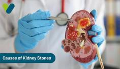 This accumulation could be of calcium, oxalate, urate, cystine, xanthine, and phosphate, there are some pre-existing conditions that may also lead to kidney stone formation so, treating them adequately and in time may also help you avoid this problem.