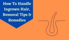 Discover the best home remedies for ingrown hair which re-enters your skin or grows within the skin. Read more on ingrown hair remedy at Livlong.