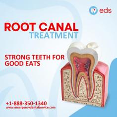 Root Canal Treatment | Emergency Dental Service

Root Canal Treatment: Your path to #strong and #healthy teeth!  Don't let dental issues spoil your love for good eats. Our Emergency Dental team is here to restore your #smile with precision and care. Schedule an appointment at 1-888-350-1340.