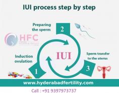For couples seeking a more targeted approach to fertility treatment, Hyderabad women & Fertility Center in Hyderabad offers state-of-the-art Intrauterine Insemination (IUI) services. Our dedicated team of experts is committed to helping you achieve your dream of parenthood.