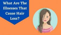 Hair loss is a common problem for anyone. But if you have experienced unexplained hair loss or face hair loss due to some health issues, you should consult a doctor immediately. This article will tell you 6 types of illnesses that cause hair loss in female.