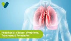 Get detailed information on pneumonia disease that inflames the air sacs in one or both lungs. Visit Livlong for more information on pneumonia and its treatment.