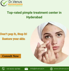 At Dr. Venus, we're the best top-rate pimple treatment center in Hyderabad. We don't just treat pimples; we're here to give you clear, healthy skin and bring back your confidence and natural glow. Join us for a transformative journey to radiant skin and a more confident you, Book Your Consultation Today!