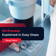 IUI Success: Understand how to improve iui success rates for people facing fertility challenges. Get the tips for successful IUI here at Indira IVF. For more information, visit!