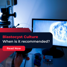 Frozen Blastocyst Transfer:  Blastocyst embryo transfer process in women infertility treatment. Understand the importance of IVF embryo transfer at Indira IVF. For more details, visit!
