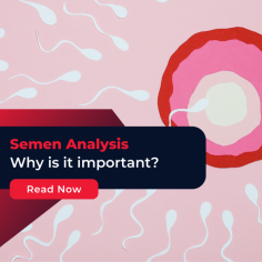 Semen Analysis: Gain insight on semen analysis test for fertility treatment. Discover how sperm count test is performed. For more details, visit!