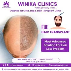Where dreams of a full, fabulous mane become reality!Bid adieu to those vanishing hairlines and welcome an extraordinary transformation! Unlock your hair's potential and unleash a new YOU! Step into a world of confidence and style.

See more: https://www.winikaclinics.com/follicular-unit-extraction-fue
