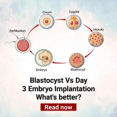 Frozen Blastocyst Transfer: Understand the process of Embryo Transfer at Indira IVF

Frozen Blastocyst Transfer:  Blastocyst embryo transfer process helps women in treating infertility. Learn more about the importance of IVF embryo transfer at Indira IVF. For more details, visit: https://www.indiraivf.com/infertility-treatment/blastocyst-culture-and-embryo-transfer