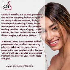 Facial Fat Transfer, is a cosmetic procedure that involves harvesting fat from one part of the body (usually the abdomen, thighs, or buttocks) and transferring it to the face to restore volume and contour. This treatment can help to address signs of aging, such as wrinkles, fine lines, and volume loss in the cheeks, temples, and around the eyes.
