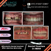 Looking for affordable dental implant options in Hyderabad, India? Look no further than Lumos Dental Care.
We offer cheap dental implants without compromising on quality or patient
care.
