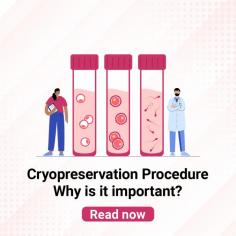 Cryopreservation: Understand the Importance of Cryopreservation in IVF Treatment at Indira IVF

Cryopreservation: Embryo Freezing process helps mens and womens in treating infertility. Learn more about the importance of cryopreservation at Indira IVF. For more information, visit: https://www.indiraivf.com/fertility-preservation/cryopreservation