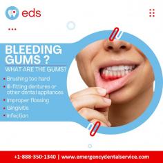 Bleeding Gums? | Emergency Dental Service

Bleeding gums is a typical dental problem in which the gums bleed while brushing or flossing.  Aggressive brushing, improperly fitted dental appliances, improper flossing, gum gingivitis, or infections can all contribute to it. If the bleeding keeps happening, get emergency dental care. Schedule an appointment at 1-888-350-1340.

