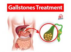 Discover specialized care for gall bladder stones in Chandigarh at Mukat Hospital. Our expert specialists offer tailored treatments and advanced solutions for gall bladder stone concerns. Experience compassionate care and cutting-edge techniques for effective relief. Trust Mukat Hospital for comprehensive, personalized care in managing gall bladder stones. 
Visit : Mukat Hospital
Address : S.C.O 47-49, Dakshin Marg, Sector 34A, Chandigarh 160022
https://maps.app.goo.gl/un65vakQZPDc8pfc7
Phone : +91 9023884444, +91-9545-12-4000, 0172-4344444
Web: https://www.mukathospital.com/gall-bladder-stones-specialist-in-chandigarh/