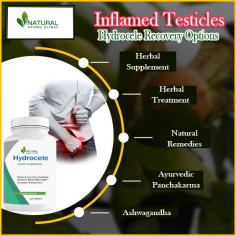 Experience relief from Inflamed Testicles with the power of herbal supplements specifically designed for hydrocele. Discover the potency of natural remedies in treating and managing hydrocele with our specialized herbal treatment.
