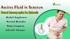 Welcome to our informative guide on Ascites Fluid in Scrotum. This condition, also known as Hydrocele, is a common medical condition that affects many men.
