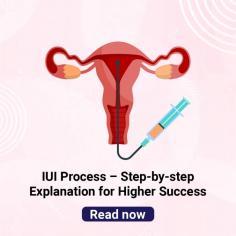 IUI Process: Understand IUI Procedure Step By Step at Indira IVF

IUI Process: Learn about the IUI procedure step by step here at Indira IVF. Get tip on what to do after IUI procedure. For more information, visit: https://www.indiraivf.com/infertility-treatment/iui-procedure