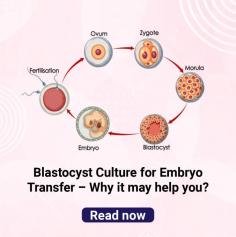 Frozen Blastocyst Transfer: Understanding Embryo Transfer Process at Indira IVF

Frozen Blastocyst Transfer: Blastocyst embryo transfer process in women infertility treatment. Understand the importance of IVF embryo transfer at Indira IVF. For more details, visit: https://www.indiraivf.com/infertility-treatment/blastocyst-culture-and-embryo-transfer